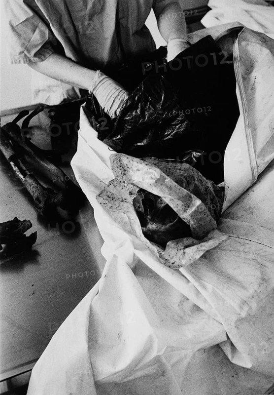 BIH, Bosnia, Tuzla, 02.10.2005, examination of bones in the ICMP