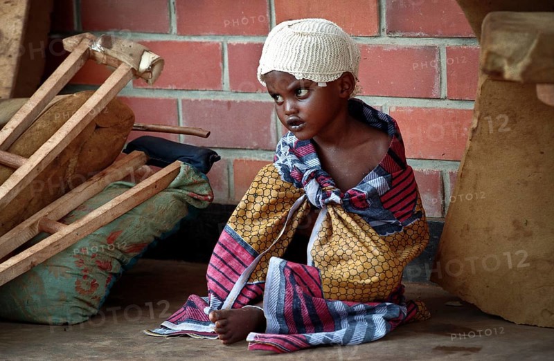 RWA Rwanda Kigali Injured Tutsi refugee children receive medical care in a makeshift hospital by doctors from Doctors Without Borders, MSF. They survived the genocide, which took the lives of 800, 000 people within 100 days. RWA Rwanda Kigali Injured Tutsi Refugee Kids in a Temporary Hospital Run by Doctors Without Borders