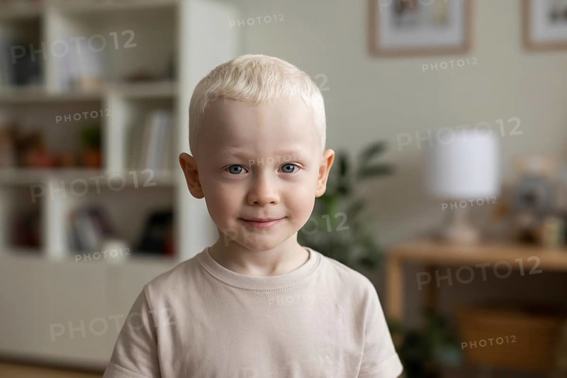 Portrait of young boy with albinism and white hair. Generative ai, AI generated