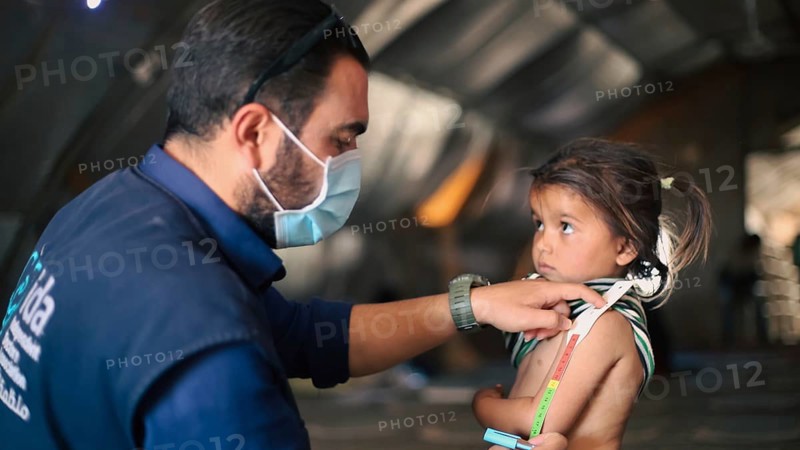 A doctor examines children's malnutrition inside a refugee camp. Malnutrition was measured using a mid-upper arm circumference belt. Aleppo, Syria October 29, 2022, Aleppo, Syria