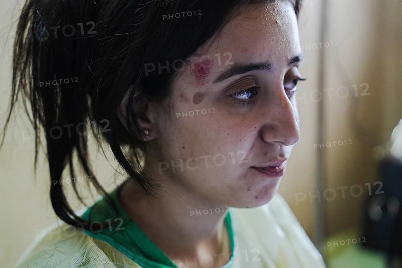 Wounded individuals receiving treatment at a hospital after being evacuated with difficulty from Sweida city in southern Syria due to sectarian violence between Druze factions and Bedouin tribes
