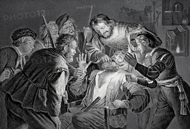 The Toothbreaker, Man at the dentist surrounded by several men, steel engraving after a painting by Gerrit van Honthorst, Historical, digitally restored reproduction of a 19th century original, Several people in historical dress pull a man's tooth by candlelight. The atmosphere is tense