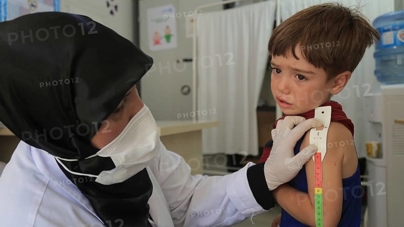 A doctor examines children's malnutrition inside a refugee camp. Malnutrition was measured using a mid-upper arm circumference belt. Aleppo, Syria October 29, 2022, Aleppo, Syria