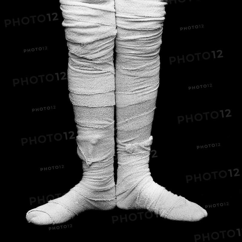 Bandaged legs are positioned closely together, highlighting medical treatment and care against a dark background. This stark contrast emphasizes the significance of wound recovery