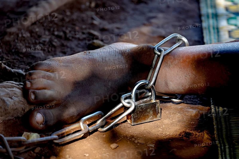 A foot tied in thick chains symbolizes mental illness, Brobo, Ivory Coast