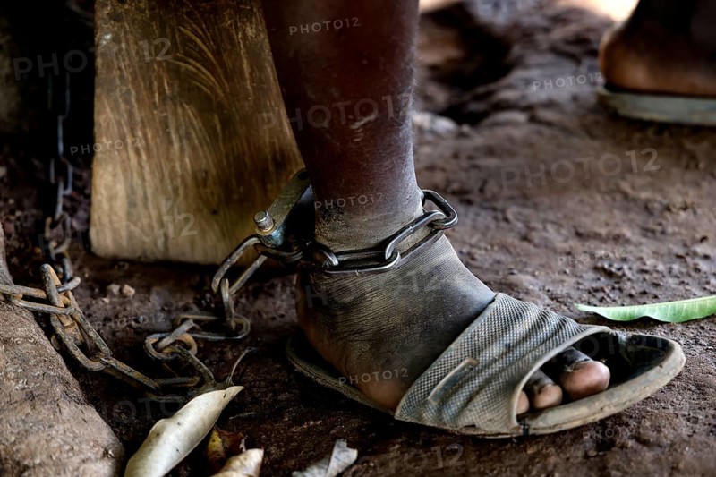 Close-up of foot in chains as a symbol of mental illness, Brobo, Ivory Coast