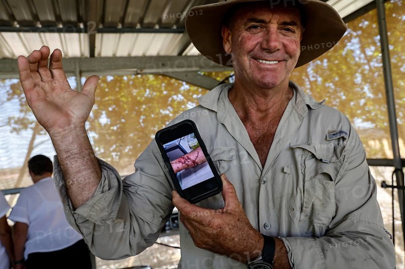 Man proudly shows the scar from a crocodile attack on his arm, Adelaide River, Northern Territory, Australia