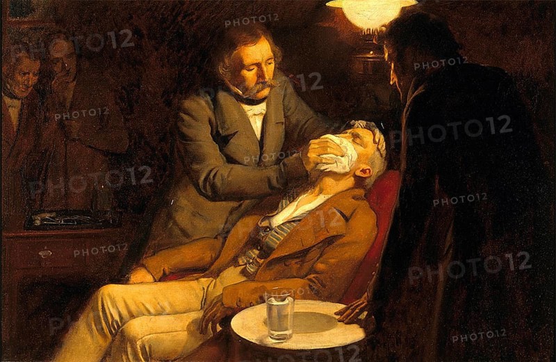 Zahnarzt, Betäubung, Anästhesie, Narkose. Die erste Verwendung von Äther in der Zahnchirurgie, 1846. Ölgemälde von Ernest Board Medizin, Medizingeschichte, Gemälde, historisch