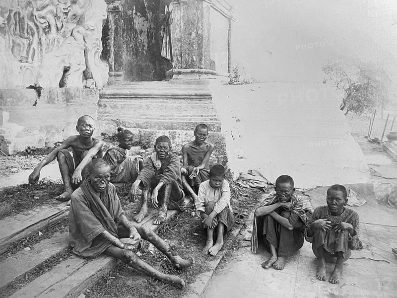Group of leprosy patients. Sick beggars at the entrance to a temple in Rangoon. Leprosy (Hansen's disease), bacterial infection caused by Mycobacterium leprae. The pathogen was discovered in 1873 by the Norwegian doctor and zoologist Gerhard Armauer Hansen. Medicine, history of medicine, photography around 1900, Rangoon, Myanmar, formerly Burma, Southeast Asia, Asia, historical