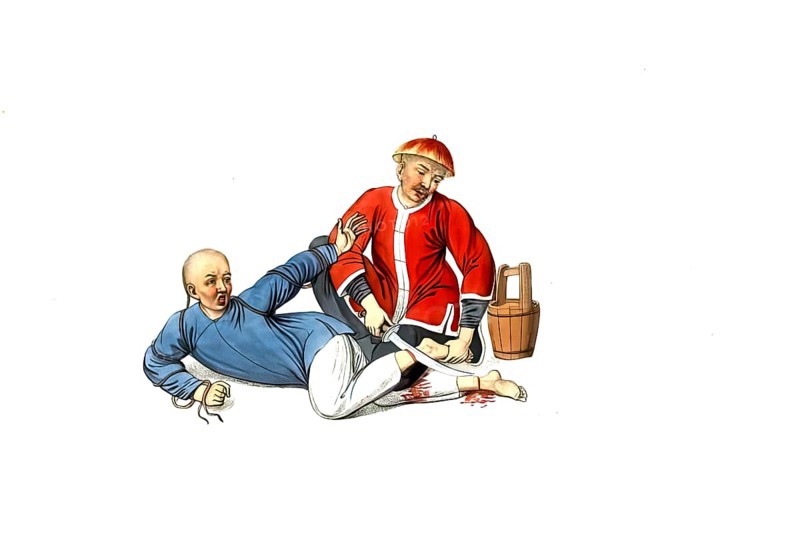 Jurisprudence, torture and punishment in medieval China, a criminal's legs are cut off. This punishment is said to have been imposed on wrongdoers who tried to flee. A vessel with chunam, a type of mortar, is ready to be applied to wounds as a hemostatic agent, authentic, digitally restored reproduction from an 18th century model, exact date of depiction unknown, historical