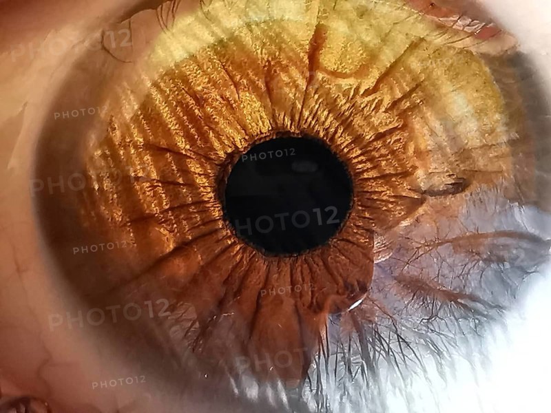 Close-up of an amber-colored eye in which trees are reflected shows the complex structure and color gradients of the iris
