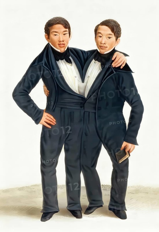 Chang and Eng Bunker, 1811–1874, known as the Siamese Twins, digitally edited