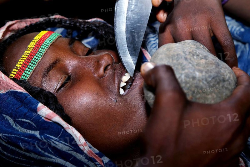 Aisha has her teeth sharpened by a man, Ahmedela, Tigray, Ethiopia