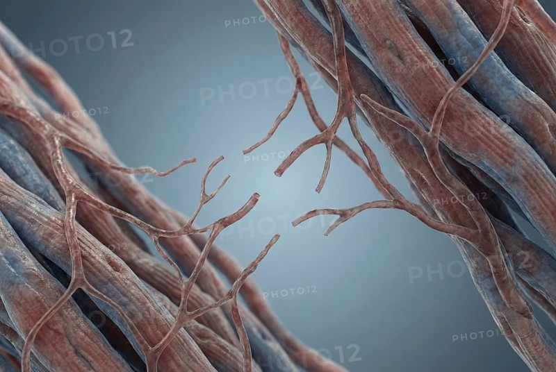 Microscopic view of the fine capillaries of the heart muscle showing the loss of small blood vessels (capillary rarefaction), a major cause of microvascular dysfunction and heart failure. Biomedical research, scientific visualisation, AI generated