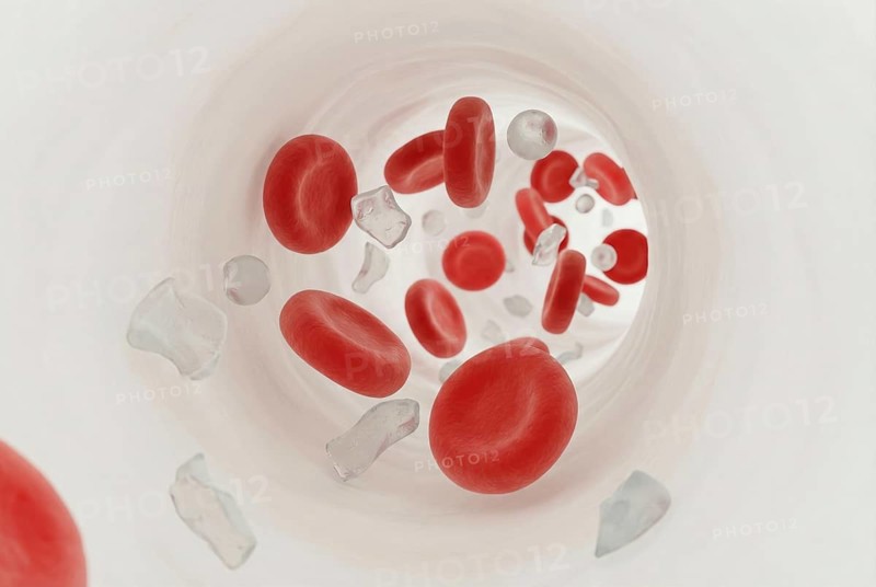 Macro illustration of microplastic particles between red blood cells in human blood, AI generated