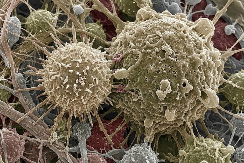 Macro-visualization of a CAR-T immune cell that binds to a tumor cell with cell membranes and tumor microenvironment, generates AI, AI generated