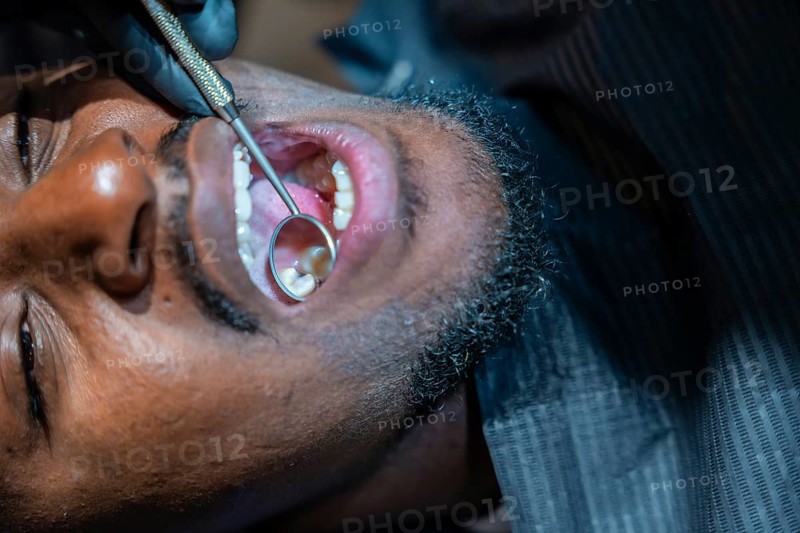 Dentist wearing black gloves using a dental mirror to examine patient's teeth during a checkup at a dental clinic