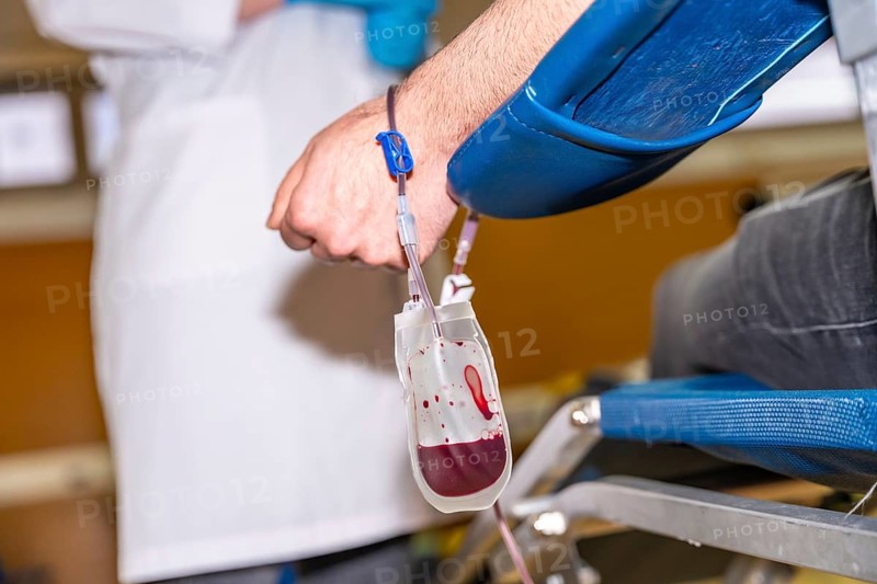 Close-up rear view of a blood bag filling while extracting blood from a volunteer