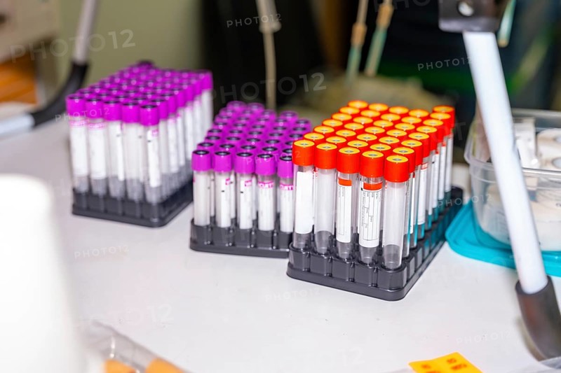 Samples of blood labeled on a table with no people