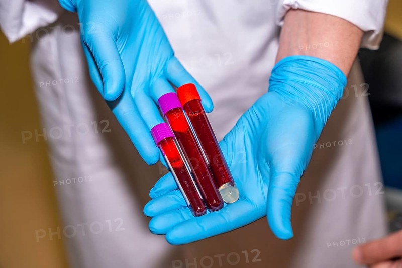 Close-up top view of a doctor showing tubes of blood samples in a donation center