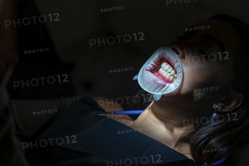 Patient receiving teeth whitening treatment with a retractor and led light in a professional dental setting