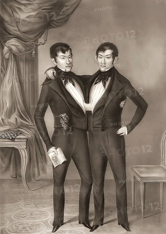 Chang and Eng Bunker, 1811–1874, known as the Siamese Twins, digitally edited
