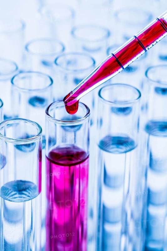 Many test tubes during an experiment in a university research laboratory. Blood, blood test, health, laboratory tubes, glass, blood test studio image