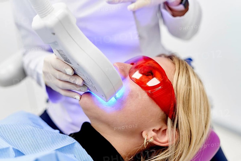 A patient undergoes a professional teeth whitening treatment at a dental clinic, wearing protective eyewear while a dentist uses a blue light device to enhance results