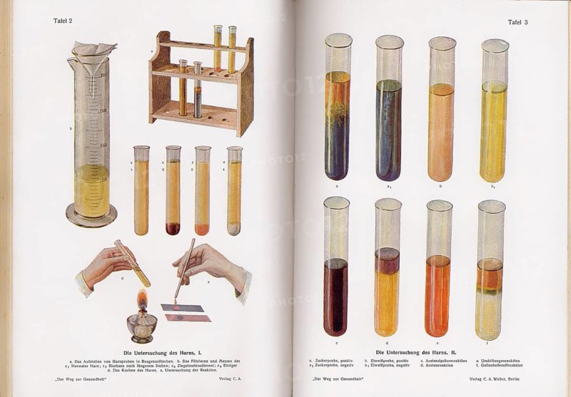 Laboratory analysis of urine, c. 1930, Urinuntersuchungen, ca. 1930