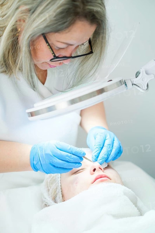A skilled esthetician cosmetologist uses a metal extractor tool to perform a deep pore cleansing procedure, focusing on impurities