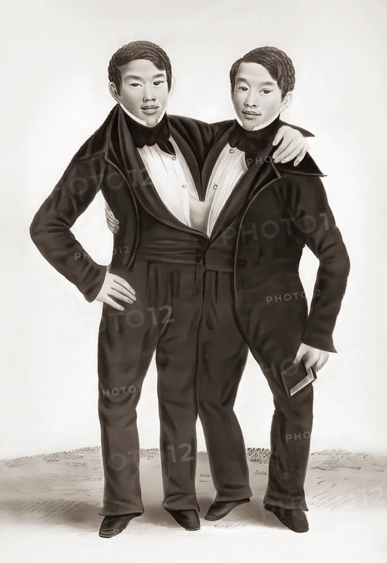 Chang and Eng Bunker, 1811–1874, known as the Siamese Twins, digitally edited