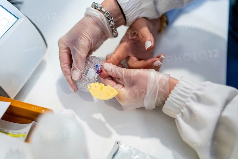 Pharmacist with protective gloves performing a finger prick blood test on a patient's finger, collecting a blood sample for glucose level monitoring in a clinic or pharmacy setting