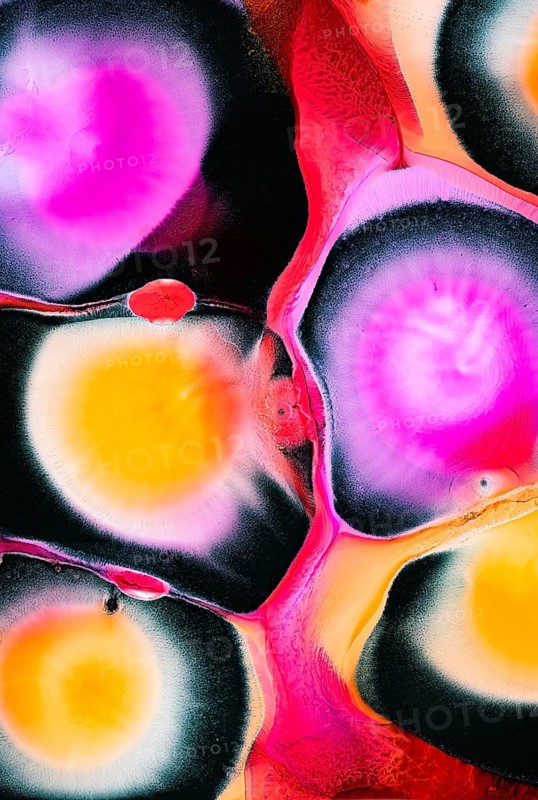 A vibrant abstract artwork featuring colorful circles and organic forms. Bright pink, yellow, and black hues blend seamlessly, creating a dynamic and eye catching composition