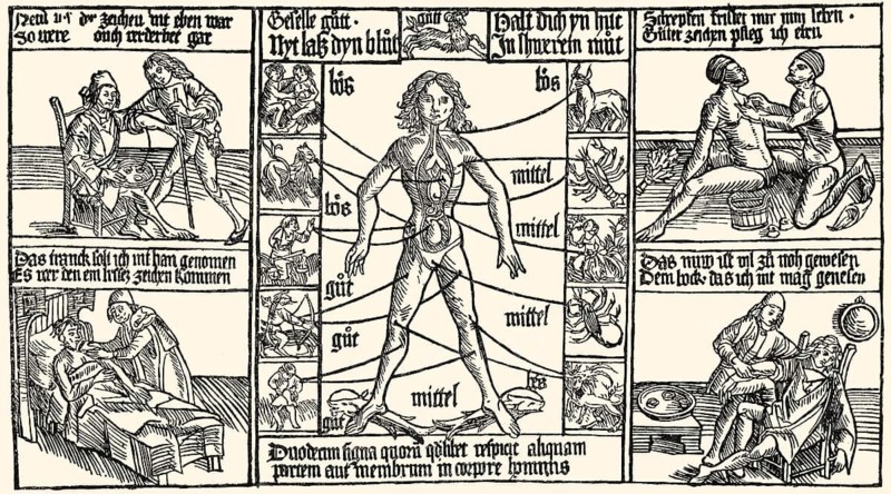 Medicine treatment, bloodletting procedure, woodcut, 1480, Medizinische Behandlung, Aderlass Verfahren, Holzschnitt, 1480