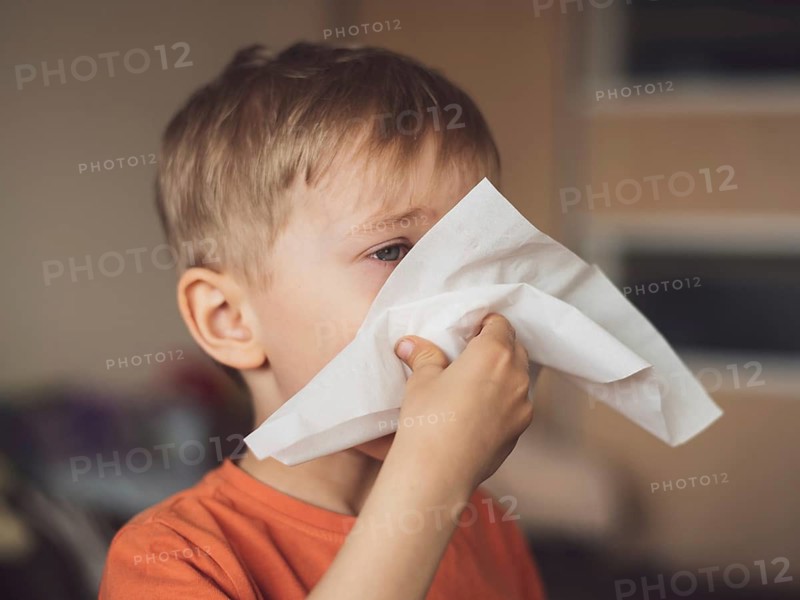Five years old boy with allergy runny nose and glazed eyes