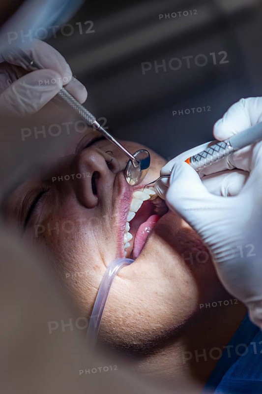 A dentist wearing gloves performs a teeth cleaning using a syringe and tools in a patient mouth. The image highlights professional dental care and hygiene practices