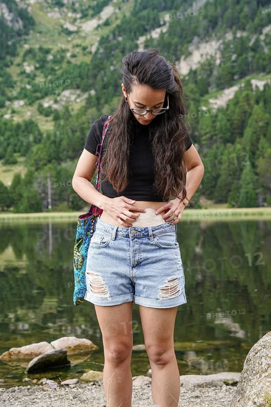 A woman with an ostomy stands by a picturesque lake, surrounded by lush greenery and mountains She inspires confidence and resilience in a serene natural setting