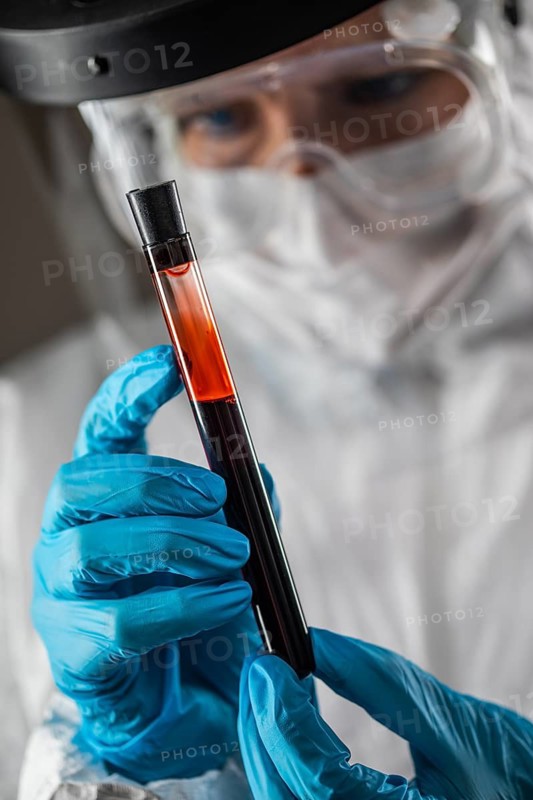 Female Lab Worker Holds Test Tube of Blood For Testing