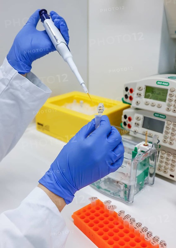 Bonn, North Rhine-Westphalia, Germany - Research in the field of immunology and infectology at the Biomedical Centre II of the University Hospital Bonn, UKB. For example, the fight against cancer by activating the patient's own immune system is to be researched here and made ready for practical application. This research also helps in the fight against the coronavirus. A doctoral student identifies and analyses individual proteins based on their molecular properties such as charge and size. At BMZ II, 150 employees from three institutes from the ImmunoSensation2 Cluster of Excellence at the University of Bonn are conducting research: the Institute of Experimental Immunology, the Institute of Clinical Chemistry and Clinical Pharmacology, and the Institute of Innate Immunology