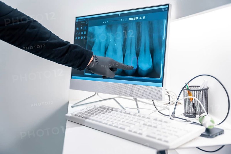 Dentist wearing black gloves pointing at teeth x ray on a computer screen, highlighting a potential issue during a consultation in a modern dental clinic