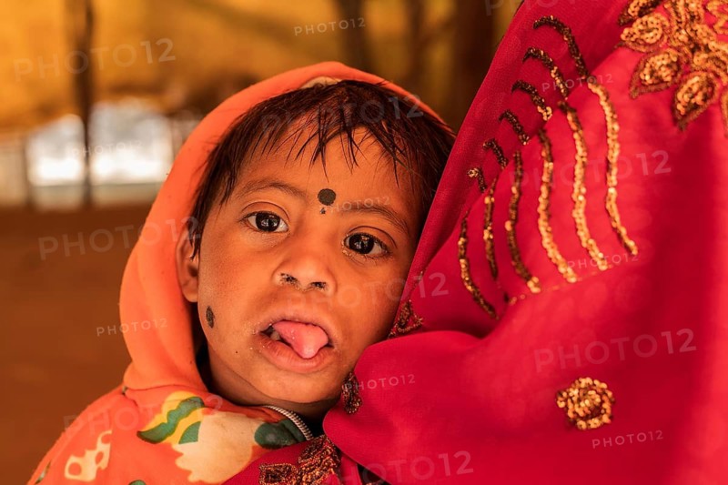 Portrait of a handicapped boy (Down syndrome) India . Photographed in his mother arms