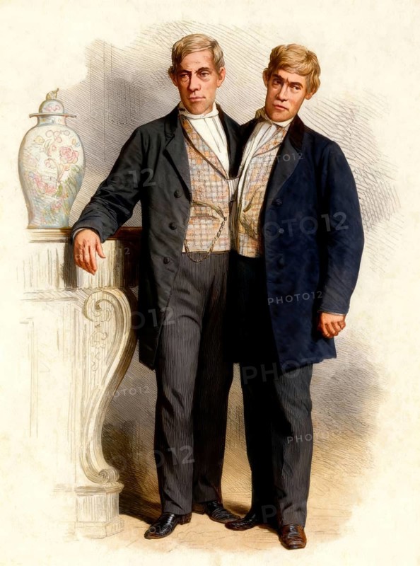 Chang and Eng Bunker, 1811–1874, known as the Siamese Twins, digitally edited