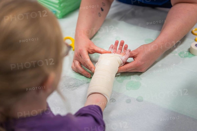A child is given a bandage on his arm. A person gently applies the splint, Krankenhaus Eröffnung, Calw, Germany
