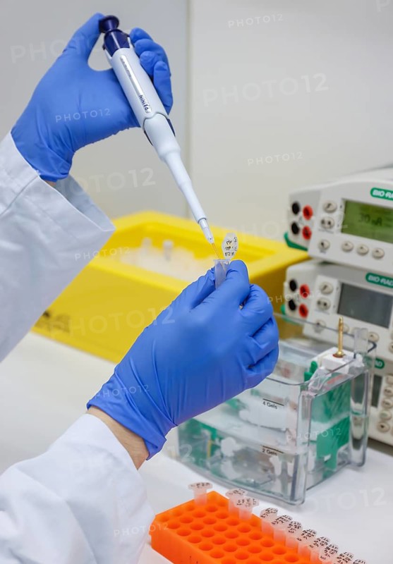 Bonn, North Rhine-Westphalia, Germany - Research in the field of immunology and infectology at the Biomedical Centre II of the University Hospital Bonn, UKB. For example, the fight against cancer by activating the patient's own immune system is to be researched here and made ready for practical application. This research also helps in the fight against the coronavirus. A doctoral student identifies and analyses individual proteins based on their molecular properties such as charge and size. At BMZ II, 150 employees from three institutes from the ImmunoSensation2 Cluster of Excellence at the University of Bonn are conducting research: the Institute of Experimental Immunology, the Institute of Clinical Chemistry and Clinical Pharmacology, and the Institute of Innate Immunology