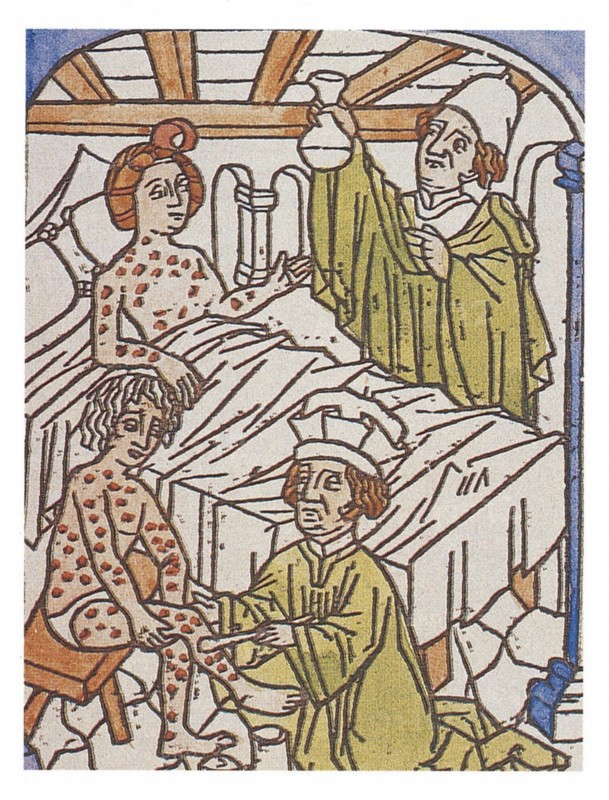 Origin of syphilis, according to the legend