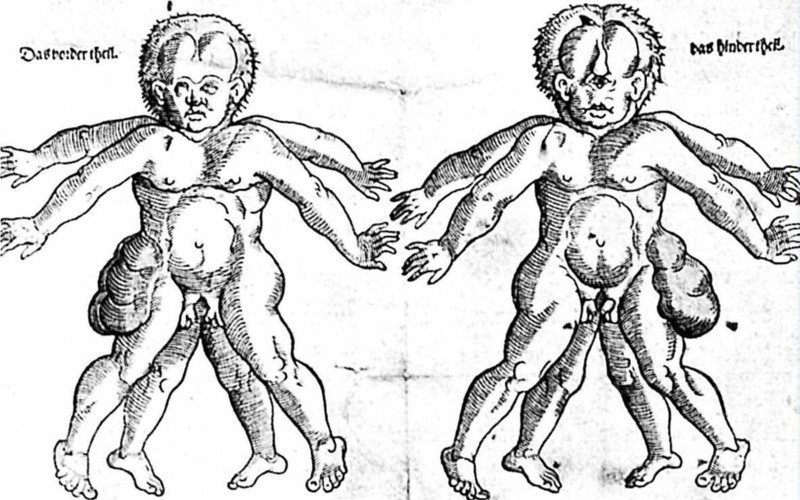 Misshapen children (illustration from a Nuremberg book, 1578)