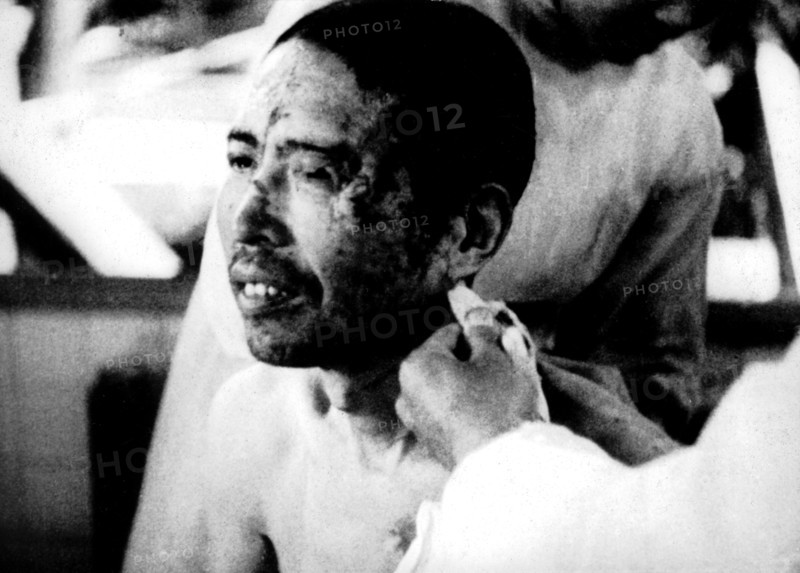 Hiroshima: Victim of the atomic bomb