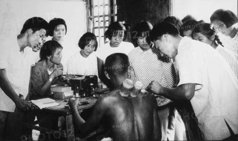 Doctor Performing Acupuncture and Utilizing Bamboo Suction Tubes while Students Watch, Malu People's Commune, Shanghai, China, 1965