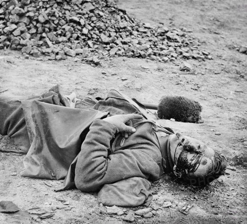 Dead South Carolina soldier in trench