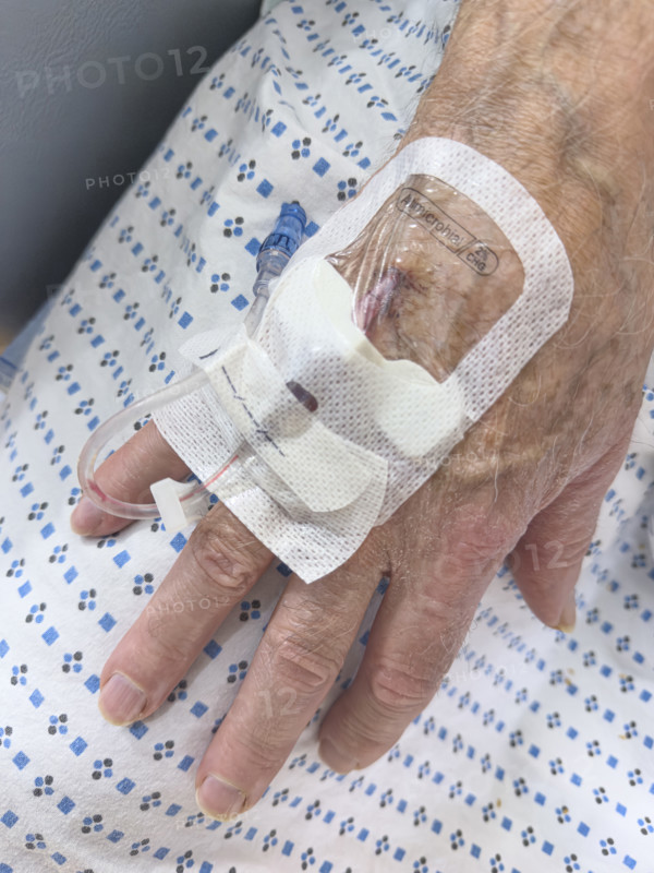 Hospital patient with IV port inserted in his hand